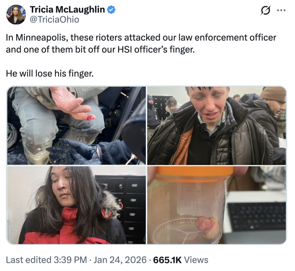 Attached media